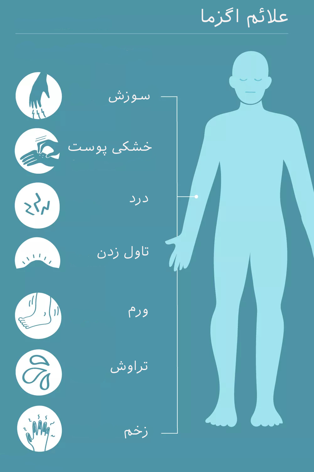 علائم اگزما