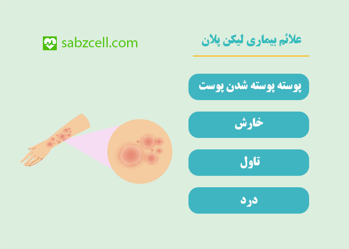 علائم لیکن پلان