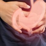 فلج معده چیست