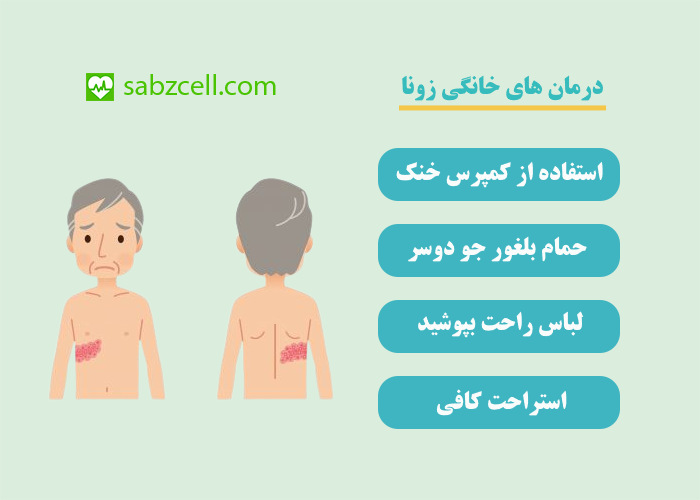 درمان های خانگی زونا