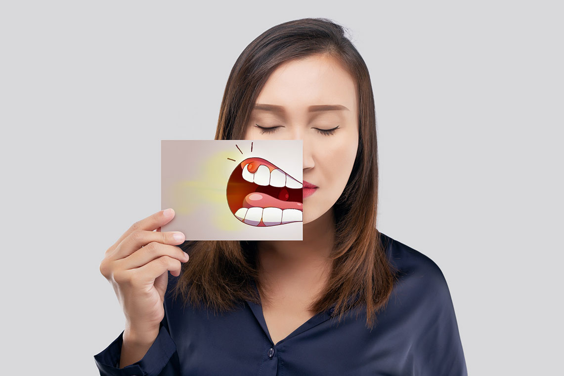 سرطان دهان چیست