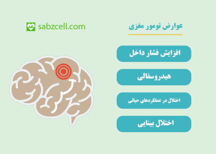 عوارض تومور مغزی