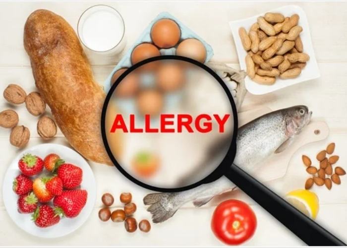 آلرژی های رایج غذایی