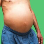 آب آوردن شکم