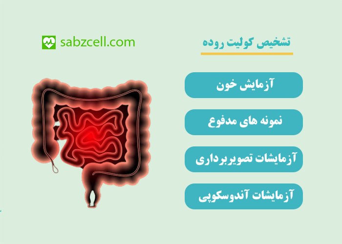 تشخیص کولیت روده