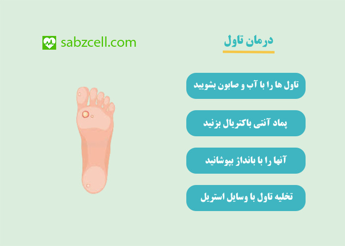 درمان تاول