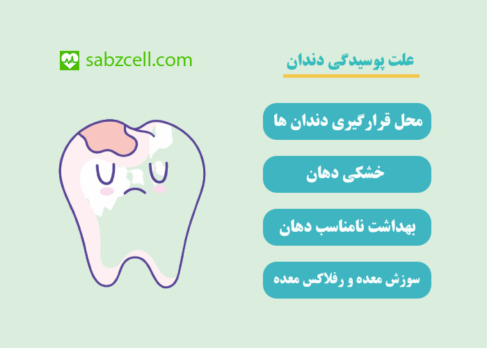 علت پوسیدگی دندان