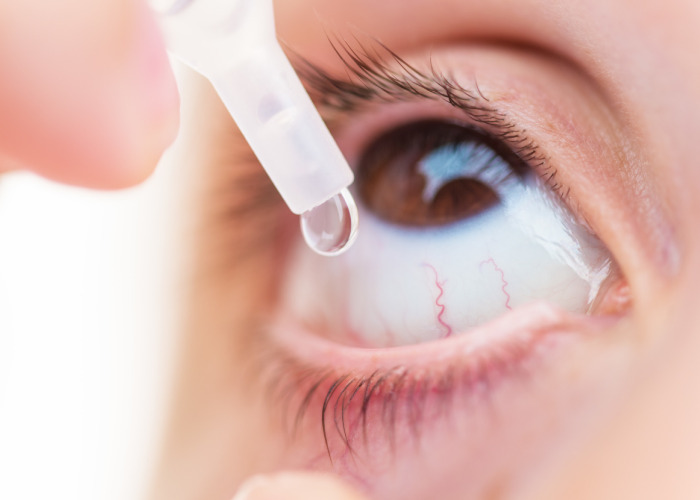 درمان خشکی چشم در زمستان