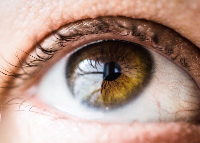 انواع سرطان چشم ملانوم چشم