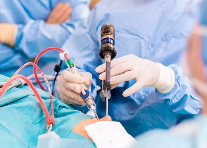 جراحی زخم معده چیست