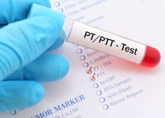 PT، PTT