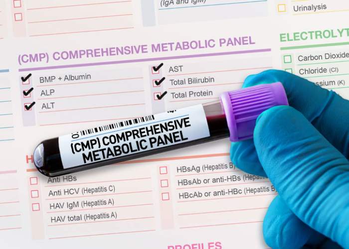 Complete Metabolic Panel