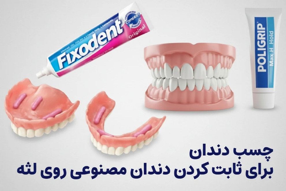 دندان مصنوعی ثابت بدون ایمپلنت(با چسب)