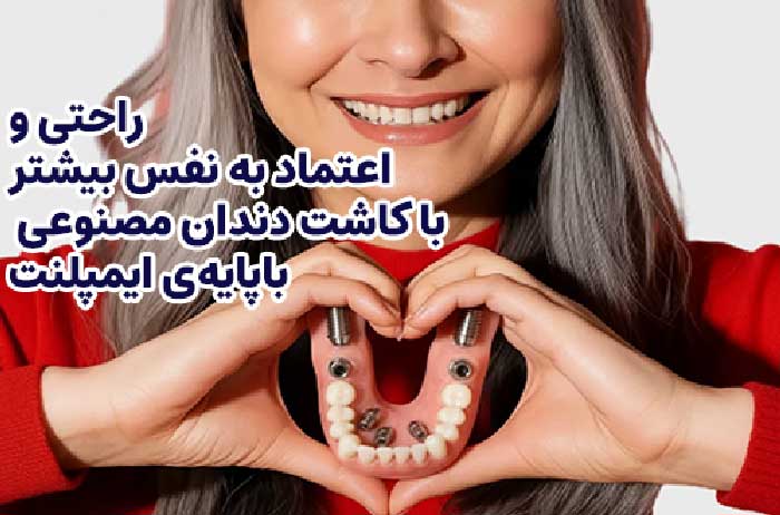 معایب کاشت دندان مصنوعی با ایمپلنت 
