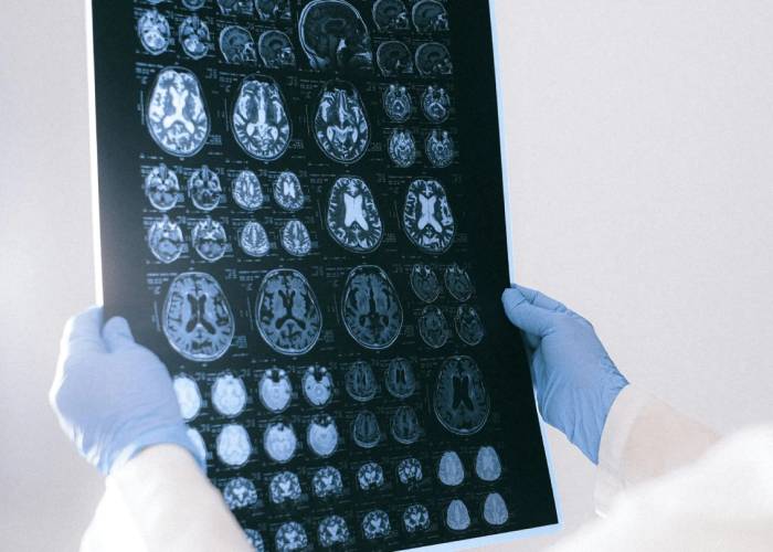 سی‌تی اسکن