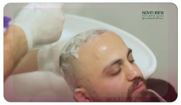 مراقبت‌های هفته اول بعد از کاشت مو