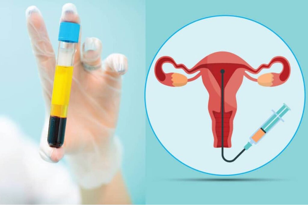 پلاسماتراپی واژن