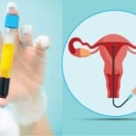 پلاسماتراپی واژن