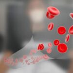 تالاسمی مینور