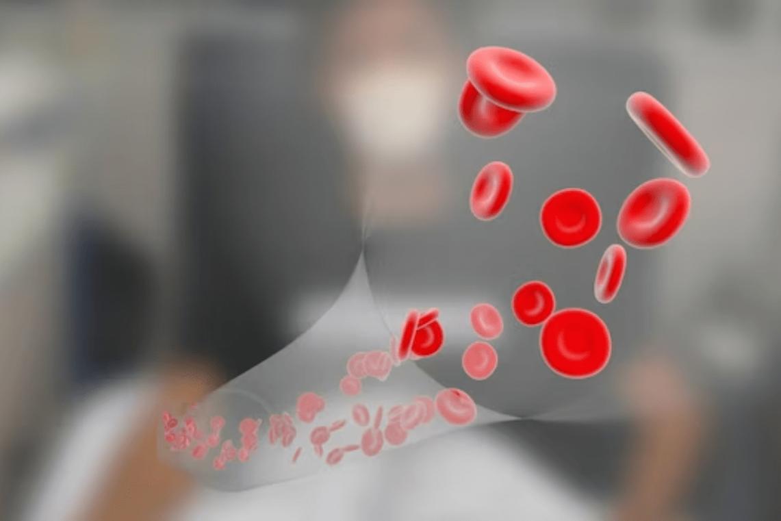 تالاسمی مینور