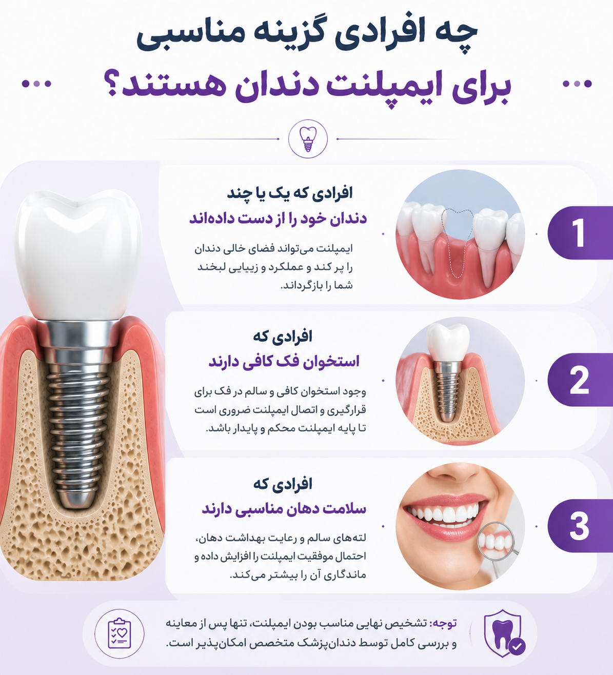چه افرادی گزینه مناسبی برای ایمپلنت دندان هستند؟
