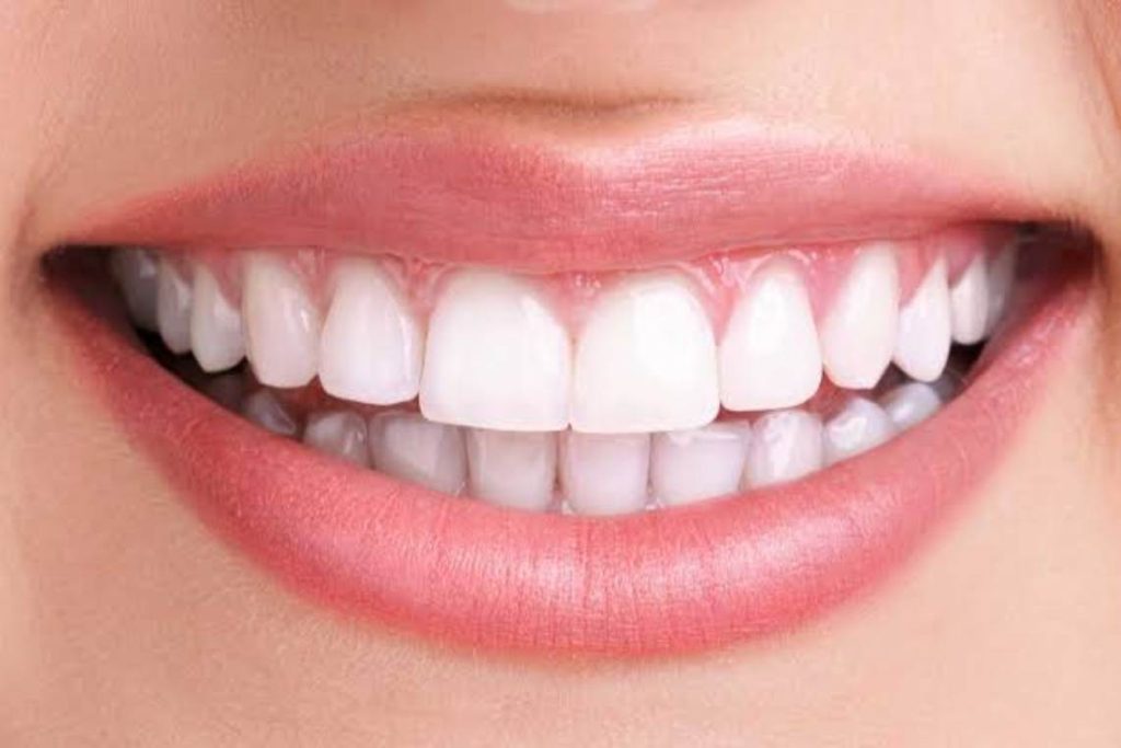 فرق بلیچینگ با جرم گیری و کامپوزیت چیست