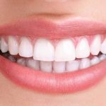 فرق بلیچینگ با جرم گیری و کامپوزیت چیست