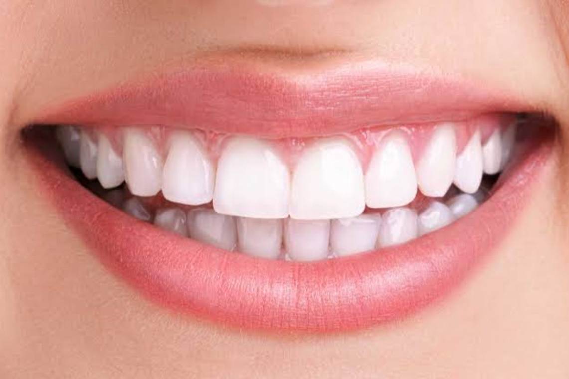 فرق بلیچینگ با جرم گیری و کامپوزیت چیست